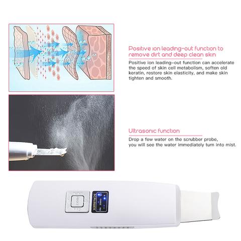 Ultrasonic Skin Scrubber — Blackhead Removal, Spa Care
