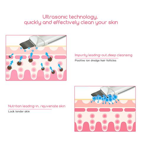 Nettoyant Facial Ultrasonique, Épurateur de Peau, Dissolvant de Points Noirs, Masseur Facial Vibrant, Peeling Ultrasonique, Appareil de Nettoyage en Profondeur 394
